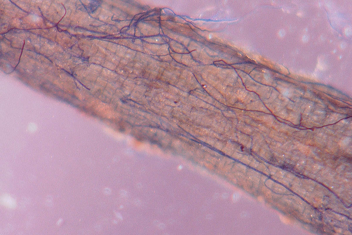 The roots of a cowpea plant, with fungi stained in blue, under a microscope.(Photo credit: Adam Cobb)